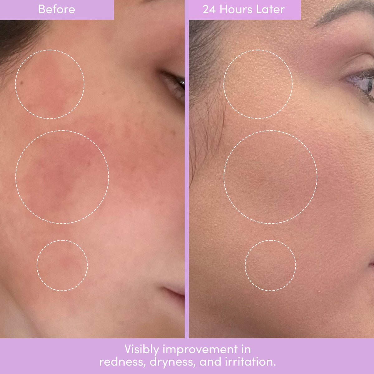 THE PLACENTA FACIAL Dark Spot Serum + Barrier Repair Cream Bundle